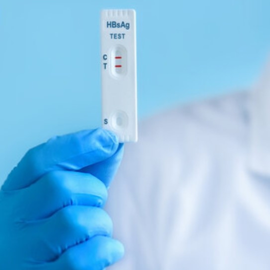 TEST NHANH HBSAG - SÀNG LỌC VIÊM GAN B