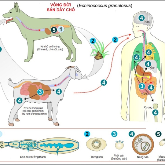 Ký sinh trùng Sán dây chó- Echinococcus IgG