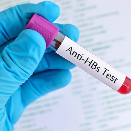 XÉT NGHIỆM ĐỊNH LƯỢNG KHÁNG THỂ VIÊM GAN B - ANTI HBS